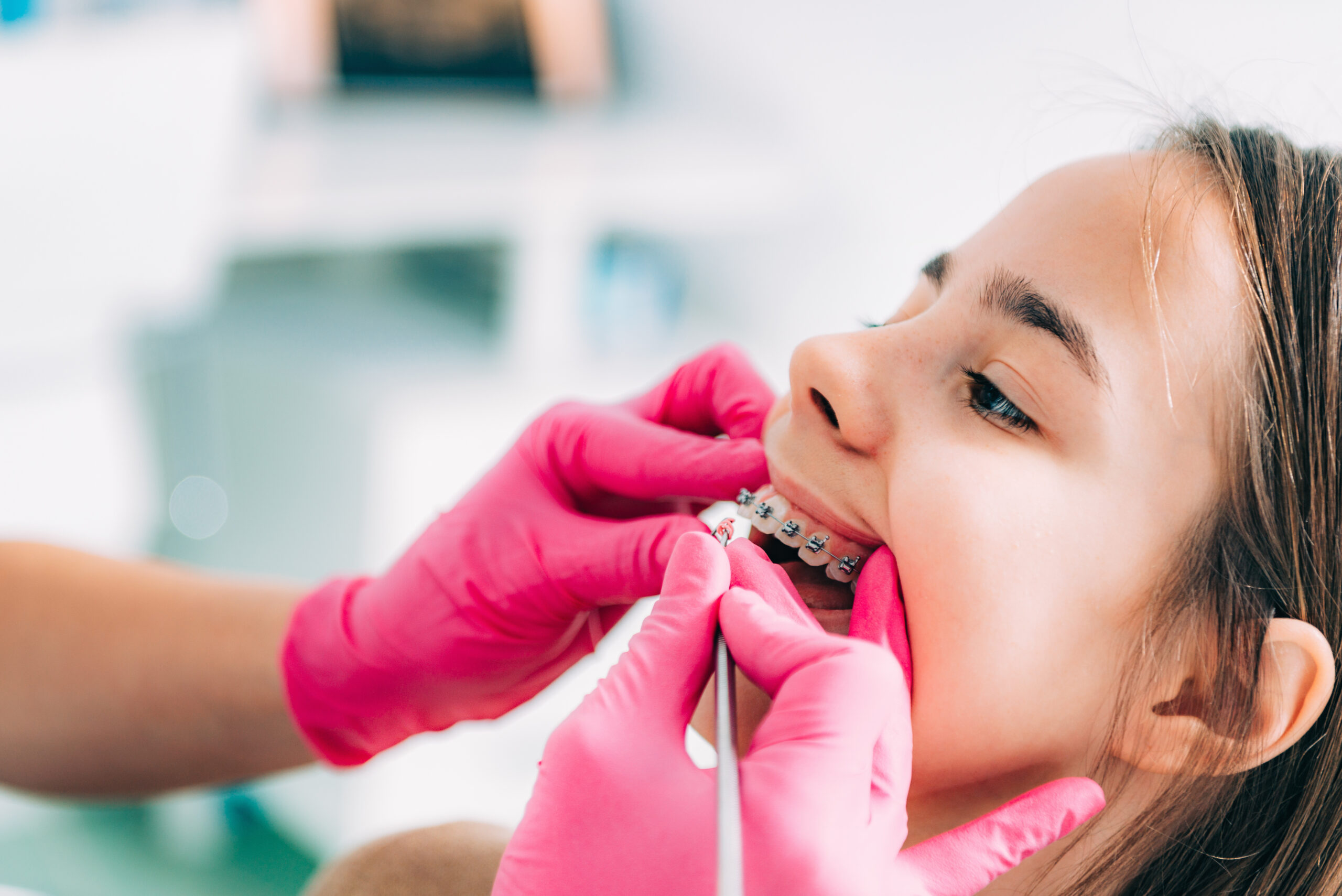 saving teeth for stem cells