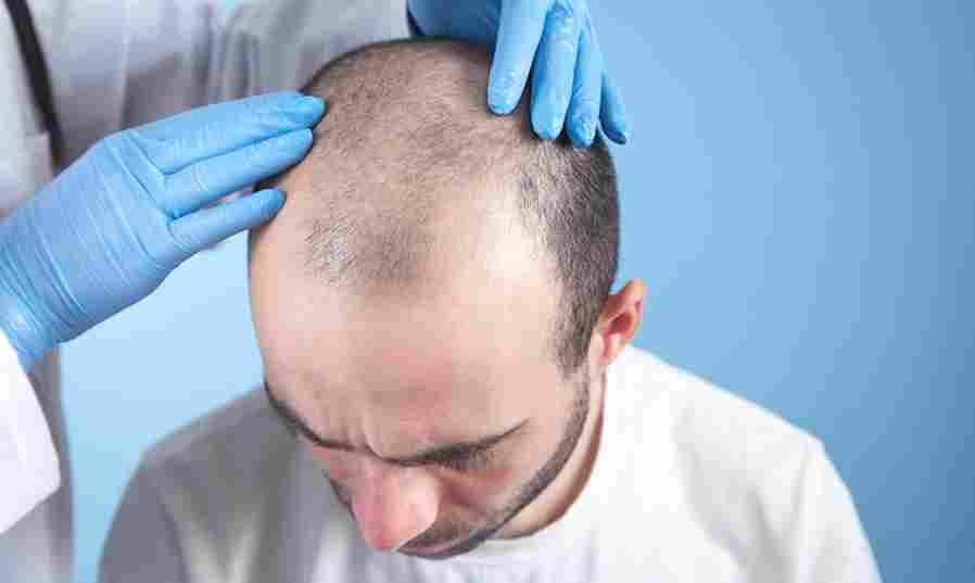Hair transplant uk